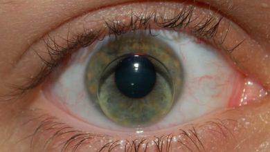 چه نکاتی را باید در هنگام استفاده از لنز چشمی رعایت کنیم